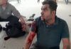 ALERT ΠΡΟΣΟΧΗ ΣΚΛΗΡΕΣ ΕΙΚΟΝΕΣ: Τούρκοι βομβάρδισαν κονβόι αμάχων και δημοσιογράφων